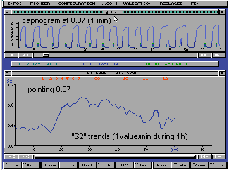 Screen capture of the capnography software