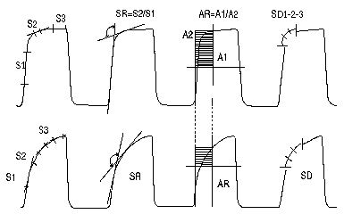 Capnographic indices