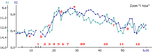 Trends of S1 and S2 during a carbamylcholine challenge test