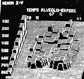 Xenon 133 : improving alveolar emptying after drug inhalation