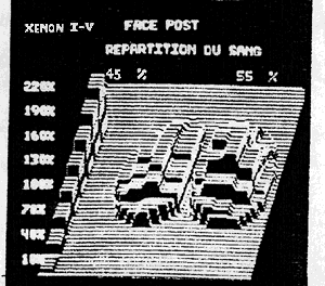 Xenon 133 : normal blood flow distribution